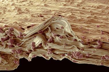 SEM image of a biodegradable plastic carrier bag