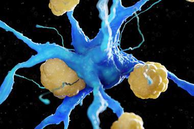 Amyloid plaque
